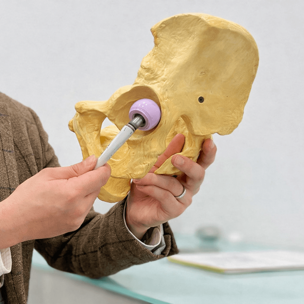 Anatomical pelvis model — hip replacement reference